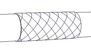 Chốt Ø1.8*9 (M06-017)